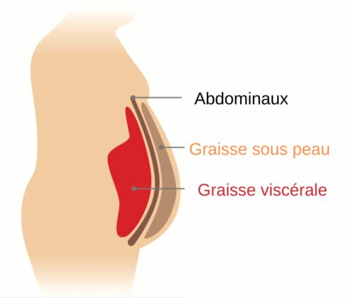 diminuer la graisse Viscerale
